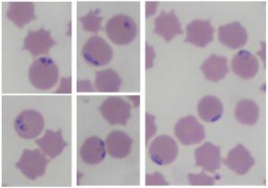 Blood smear of bovine blood depicting parasitized RBCs with intracellular inclusions of Babesia spp Blood smear of bovine blood depicting parasitized RBCs with intracellular inclusions of Babesia spp