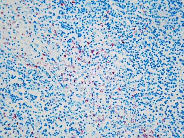 Ziehl-Nielsen staining and histological examination of tissues from this case showing extensive acid-fast bacteria (red colonies) characteristic of Johne’s disease (MAP)