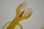 The image shows the posterior end of a male Haemonchus contortus parasite. The dark-coloured sharp ‘spicules’ assist in copulation, and allow microscopic identification of the worm in the laboratory