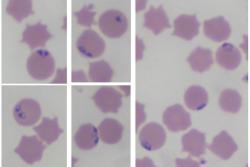 Blood smear of bovine blood depicting parasitized RBCs with intracellular inclusions of Babesia spp