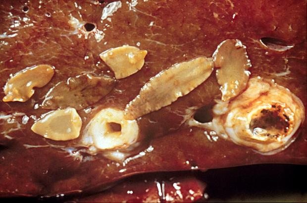 Adult liver flukes in cattle liver