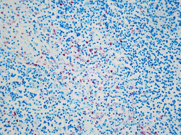 Ziehl-Nielsen staining and histological examination of tissues from this case showing extensive acid-fast bacteria (red colonies) characteristic of Johne’s disease (MAP)