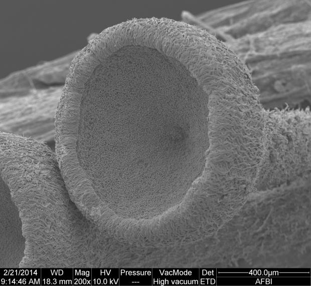 Fig. 2. Apothecia of H. fraxineus. These are about 2 mm across