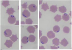 Blood smear of bovine blood depicting parasitized RBCs with intracellular inclusions of Babesia spp