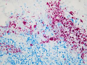 Ziehl-Nielsen staining and histological examination of tissues from this case showing extensive acid-fast bacteria (red colonies) characteristic of Johne’s disease (MAP)