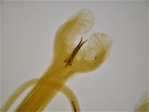 The image shows the posterior end of a male Haemonchus contortus parasite. The dark-coloured sharp ‘spicules’ assist in copulation, and allow microscopic identification of the worm in the laboratory