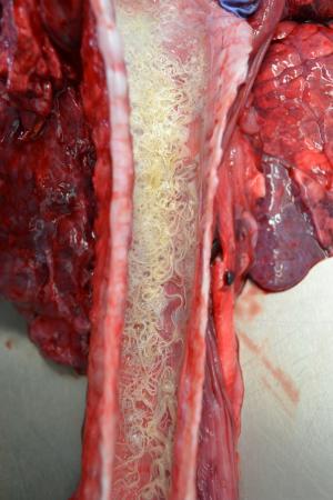 Severe lungworm infection in cattle submitted for post mortem to AFBI Omagh